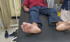 Wartawan Jombang Jadi Korban Penganiayaan, Didesak Penegakan Hukum harus konsisten